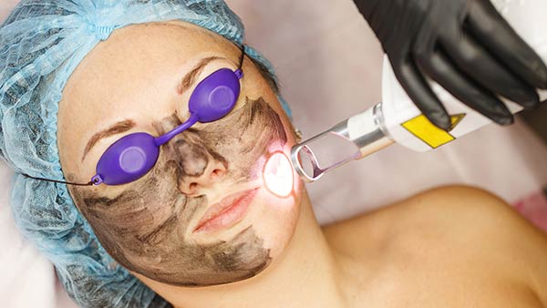 carbon peel china doll facial melbourne