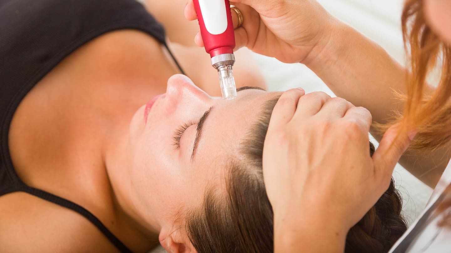 micropen microneedling melbourne